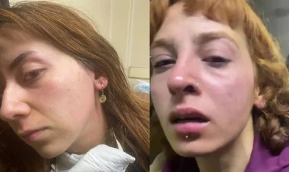 Gazetecilere polis şiddeti... DİSK Basın-İş'ten sert tepki: 'Savcıları göreve davet ediyoruz!'
